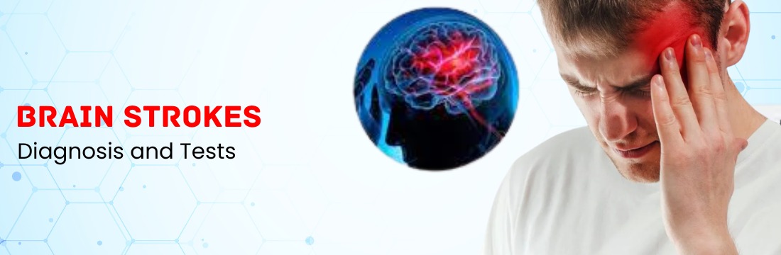 Understanding Brain Strokes: Diagnosis, and Tests